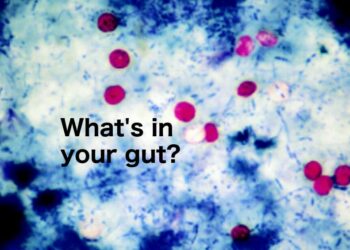 Cyclospora cases surge to nearly 600 in Michigan