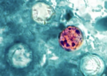 Infections from Cyclospora parasite continue sharp increases
