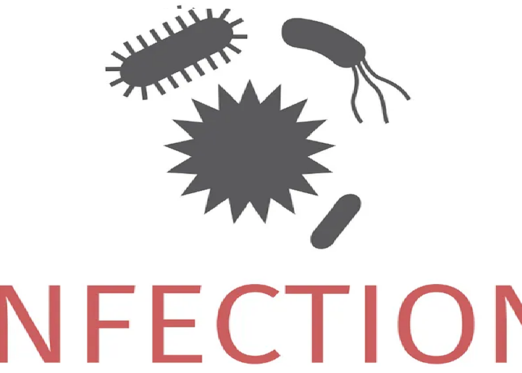 Swiss food agency reports spike in outbreaks
