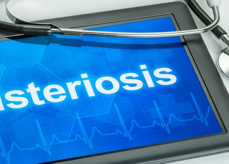 Scientists flag Listeria as an emerging threat in Pakistan