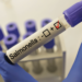 More than 80 patients reported in new Salmonella outbreak