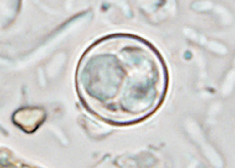 CDC reports more than 1,800 additional Cyclospora patients in past week