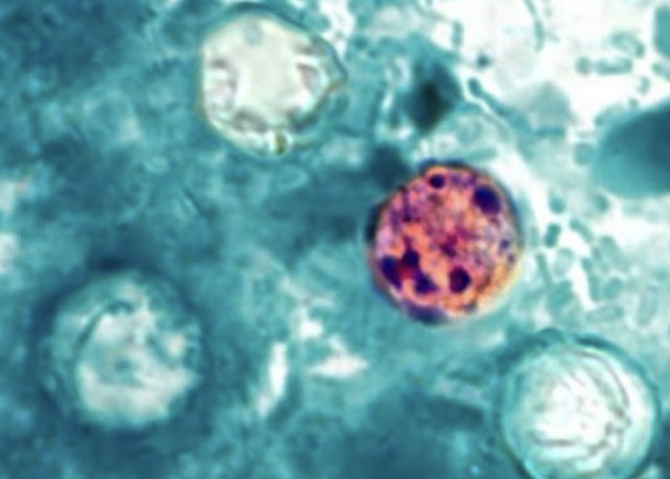 Patient count in Cyclospora outbreak in Michigan at more than 14,700