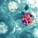 Patient count in Cyclospora outbreak in Michigan at more than 14,700